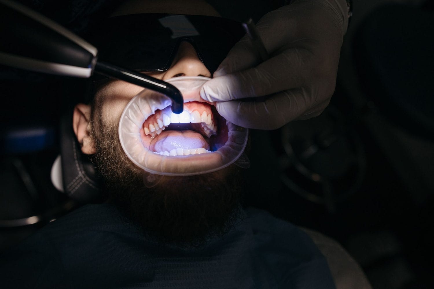 Dental laser handpiece being used on a patient under a curing light