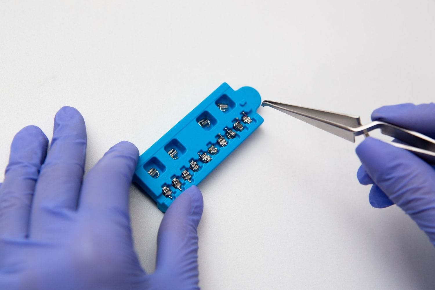 Orthodontist lifting a metal bracket from a bonding tray with tweezers