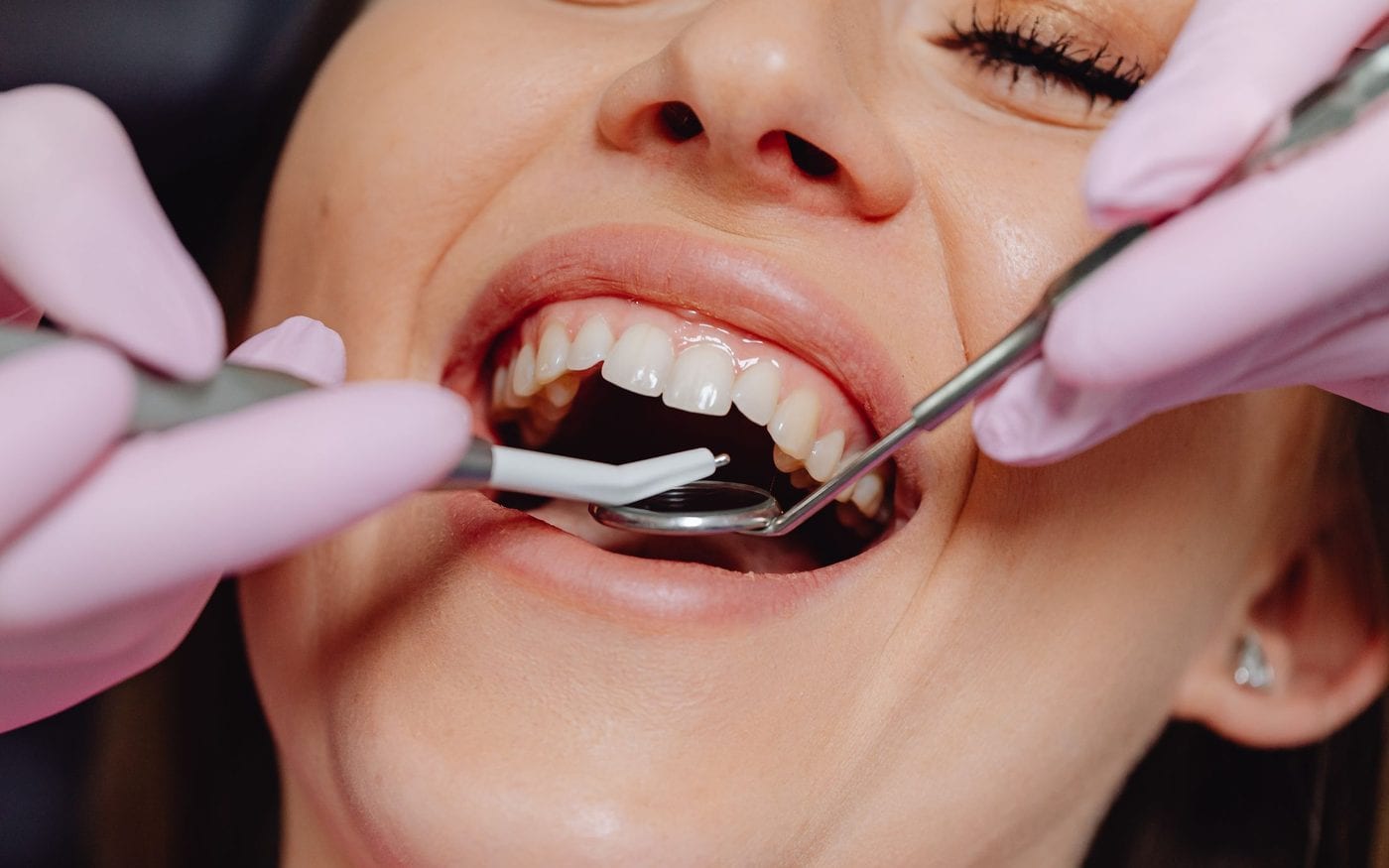 Dentist examining a patient's teeth with a mirror and probe