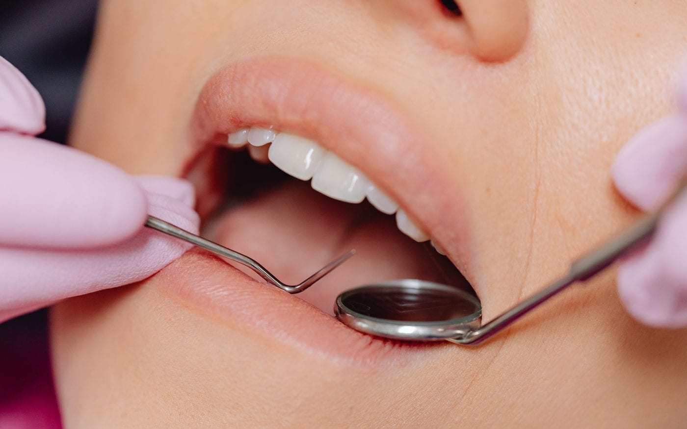 Close view of a gum examination with a dental mirror and probe